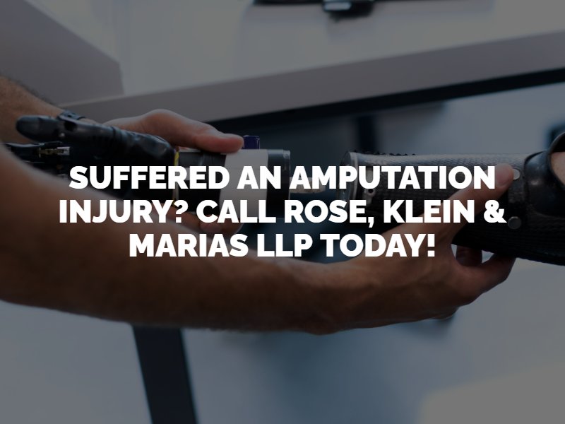 Los Angeles Amputation Injury Attorney