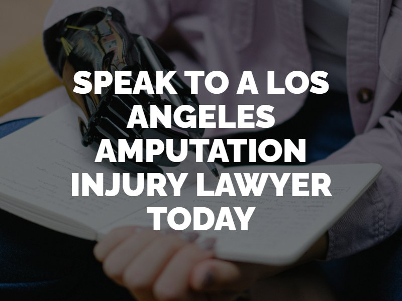 Los Angeles Amputation Injury Lawyer