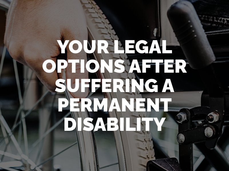 RKM's permanent disability lawyers in ventura will detail your legal options 
