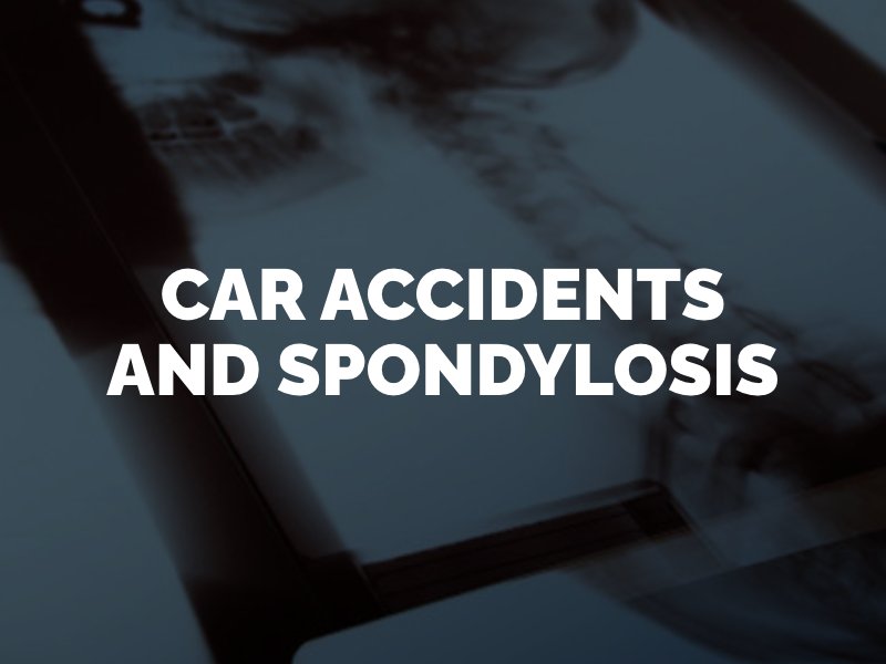 How car accidents can cause spondylosis