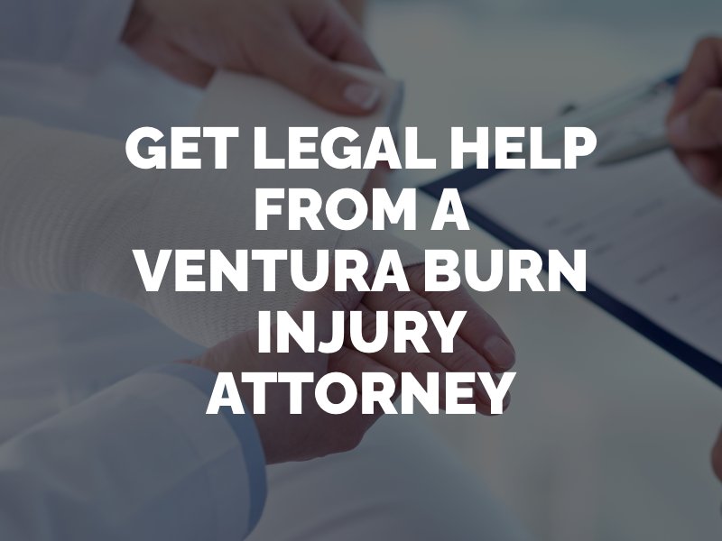 get legal help from a ventura burn injury attorney