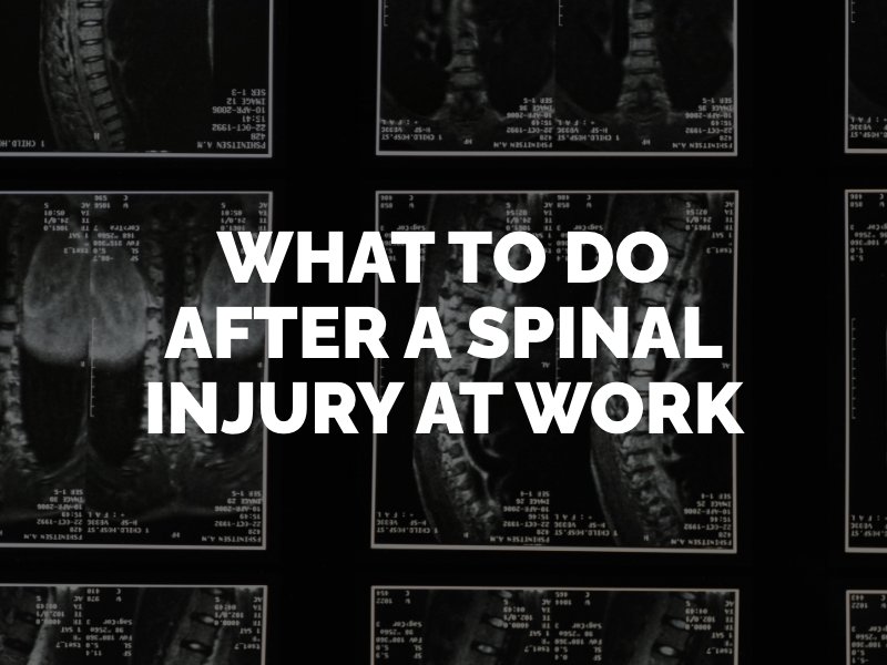 what to do after a spinal injury at work
