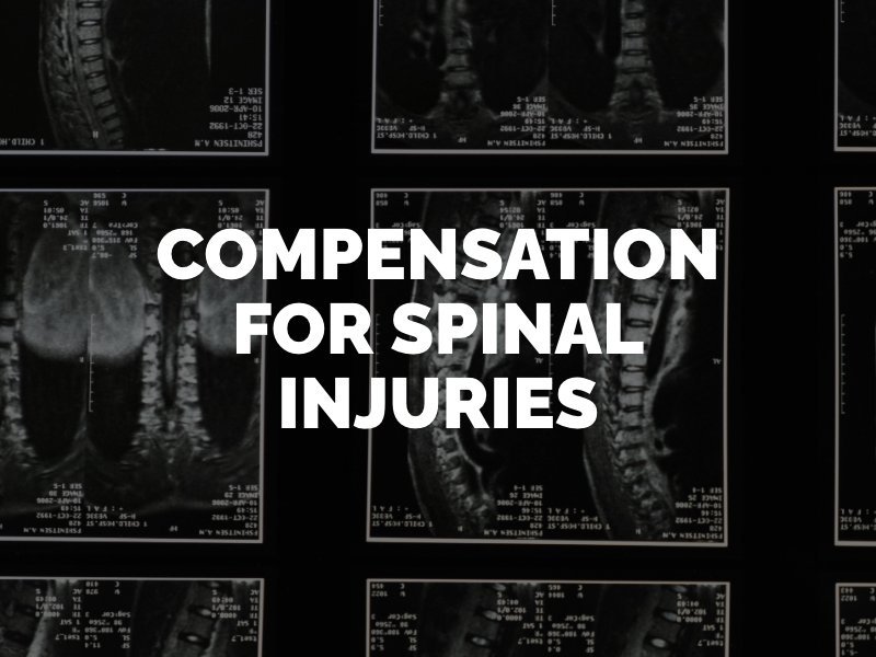 compensation for spinal injuries